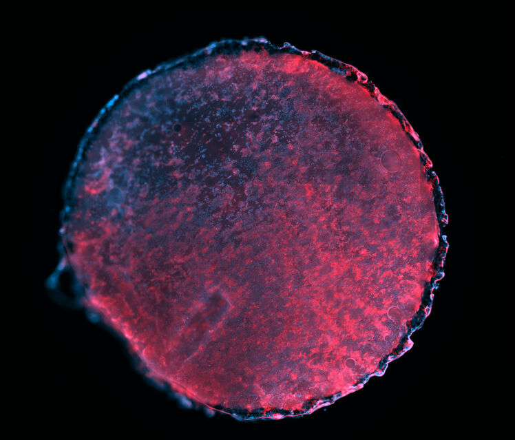 Microscope image of stem cell patch taken by Dr Richard Tan